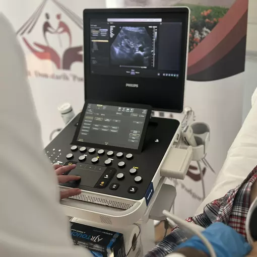 Ultrazvuk