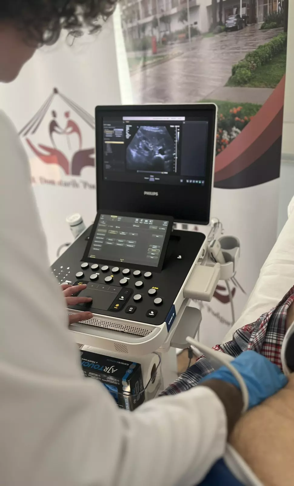 Ultrazvuk